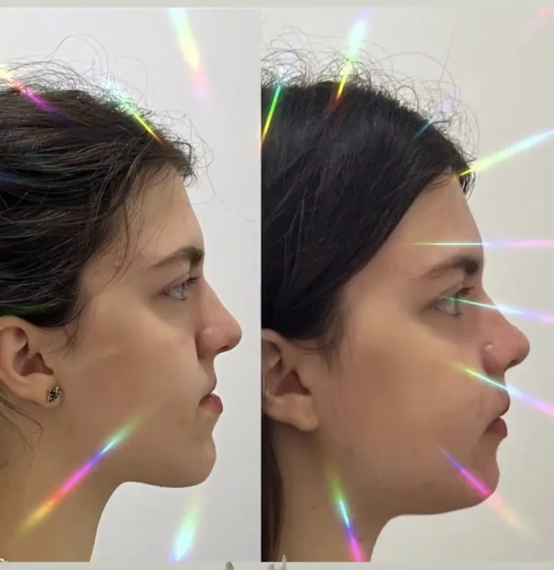 Alanya HEALTHY TEETH Dental Aesthetic — Медицина в Аланье: Онлайн-заказ, цены и отзывы